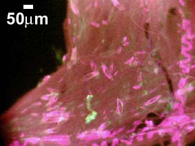 microbial felt in fluorescent light