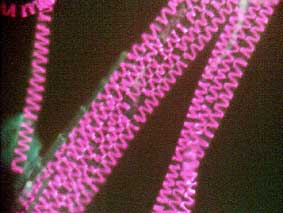 spirogyra in fluorescent light
