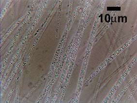 sulfur granules in sulfur bacteria filaments